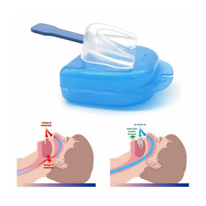 Anti Snoring Aid Mouth Guard - Adjustable Sleeping and Breathing Mouthguard